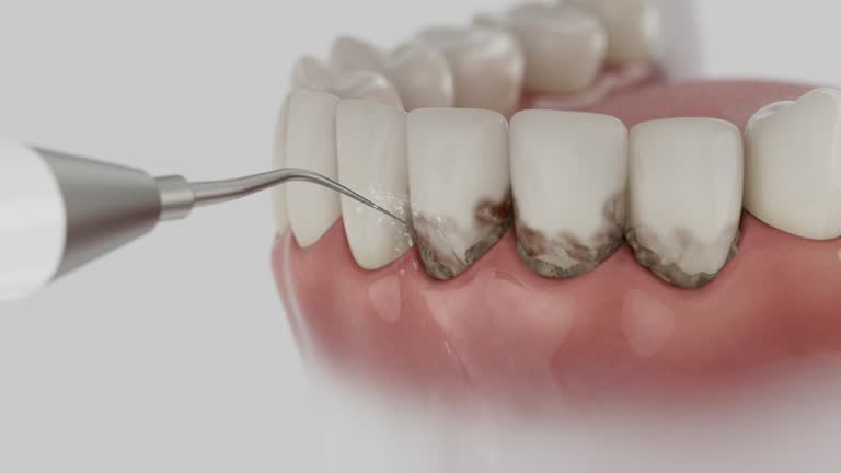 Reliable Wisdom Tooth Removal contractor in Ottawa County County, MI by Dentist Open Now